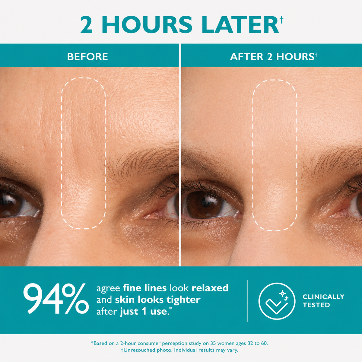 Peptide Skinjection Peptide Infused Face + Eye Tape
